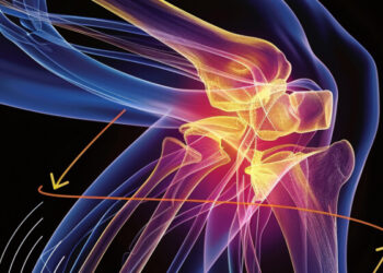 Number One Thing That Makes Bad Knees Worse